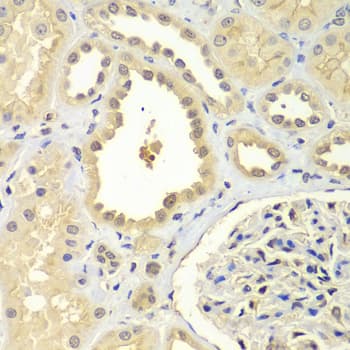 ZNF346 Antibody