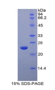 Rat IFNA5 / Interferon Alpha 5 Protein (Recombinant His-T7)
