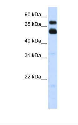 VISA / MAVS Antibody (aa470-519, HRP)