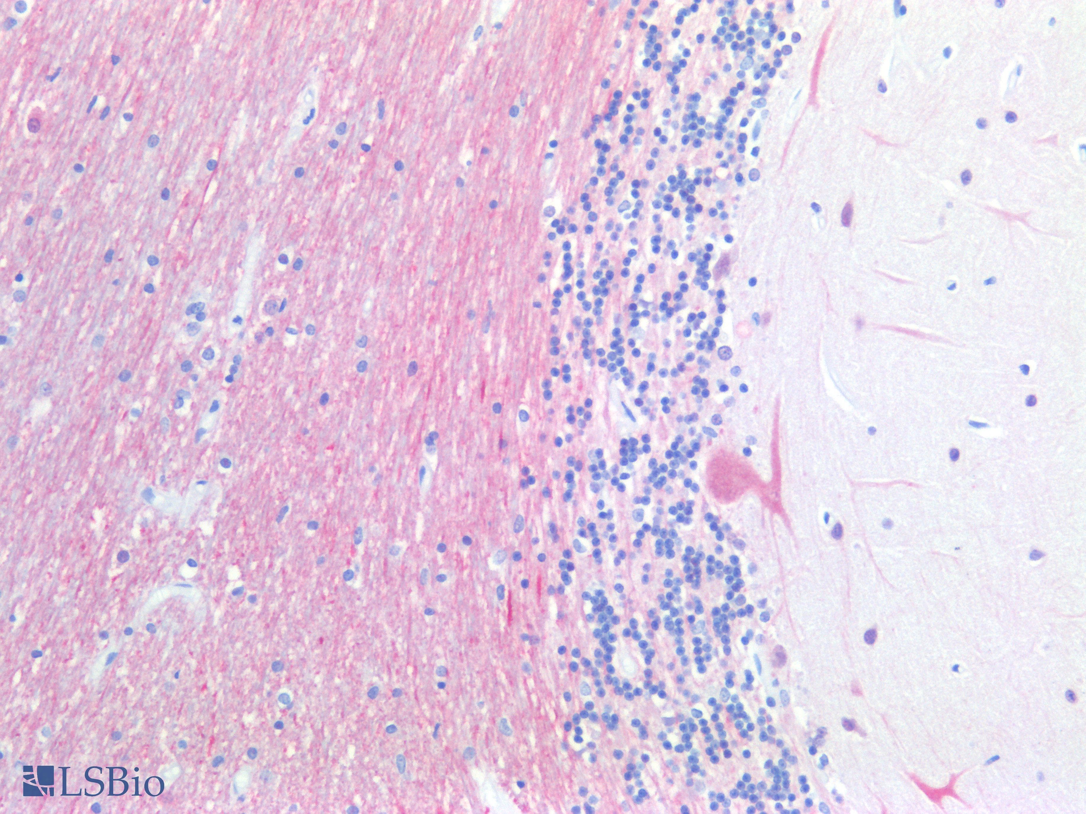 PathPlus™ UCHL1 / PGP9.5 Antibody
