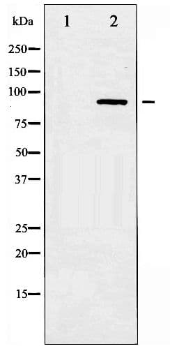 STAT3 Antibody (phospho-Tyr705)