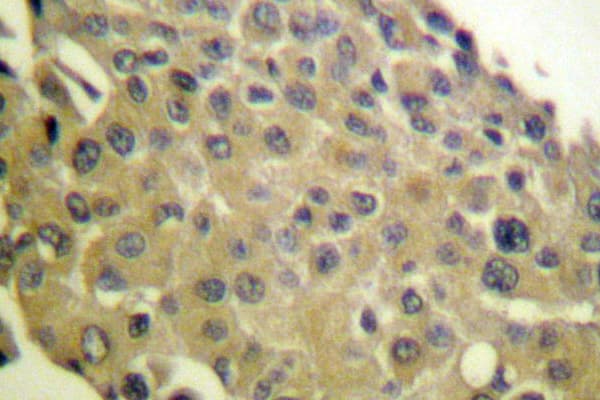 PPP1CA / PP1-Alpha Antibody (Gly315)