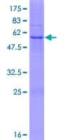 Human HSD17B3 Protein (Recombinant GST)