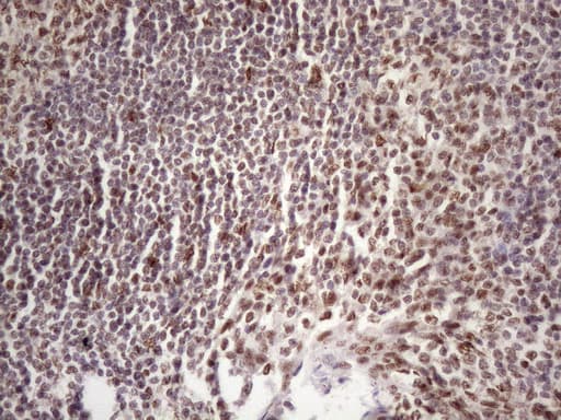 TP53BP1 / 53BP1 Antibody (aa1-300, clone OTI2H6)