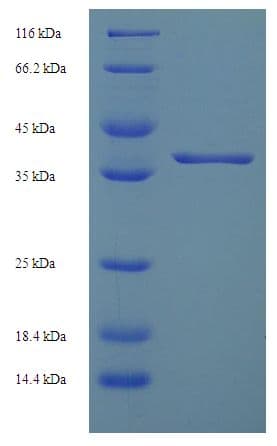 Human ASB6 Protein (Recombinant His-SUMO)