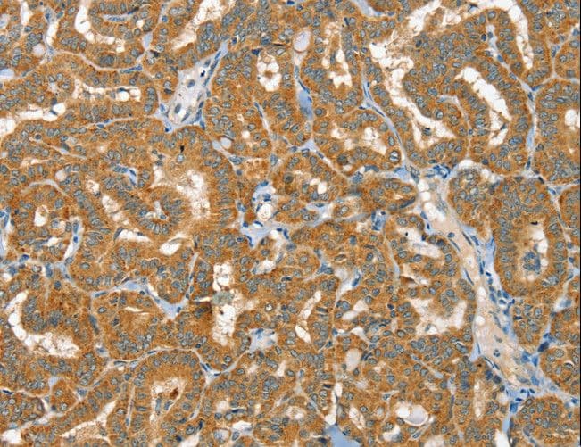 RAB25 Antibody