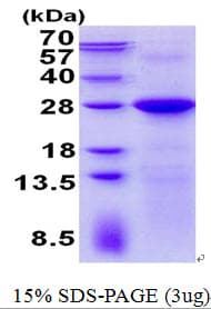 Human LIN7C / VELI3 Protein (Recombinant His)