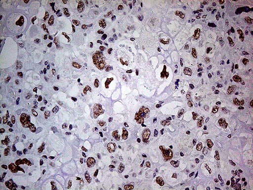 POLR2A / RNA polymerase II Antibody (aa1351-1614, clone OTI1E5)