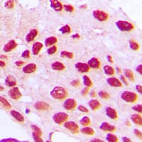 HOXC6 Antibody (C-Terminus)
