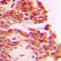 IHC-plus™ Polyclonal Rabbit anti-Human CPA1 / Carboxypeptidase A Antibody (Internal, IHC, WB)