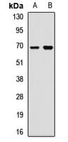 AHSG / Fetuin A Antibody