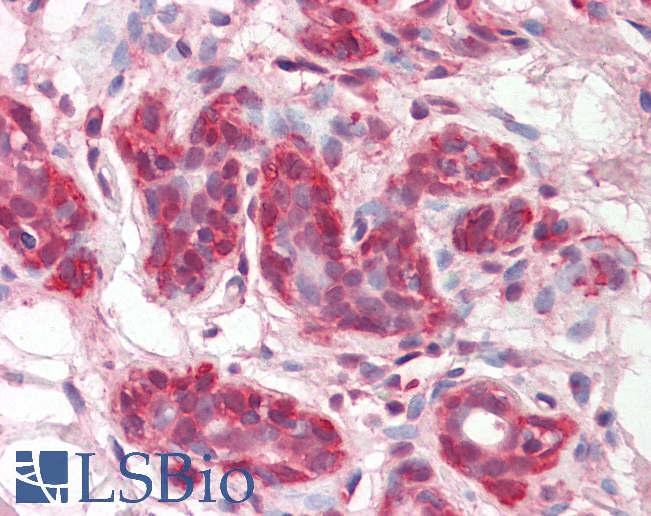 IHC-plus™ AML1 / RUNX1 Antibody (clone 2B5)