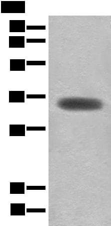 MYOZ2 / CS-1 Antibody