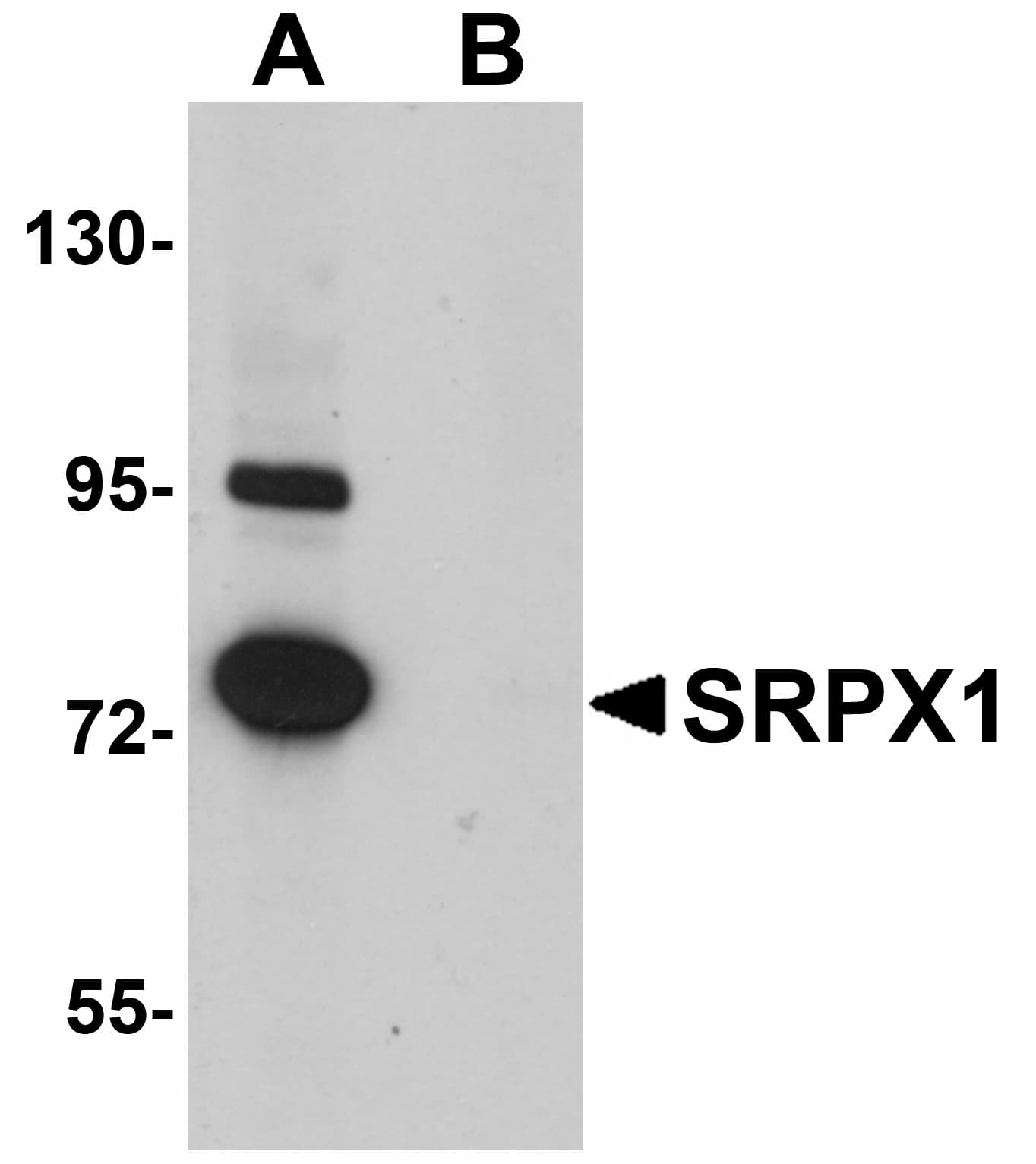 IHC-plus™ SRPX Antibody
