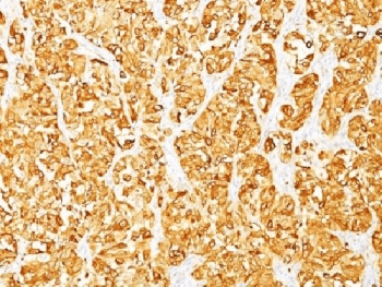 MLANA / Melan-A Antibody (clone M2-7C10, Azide-free, BSA-free)