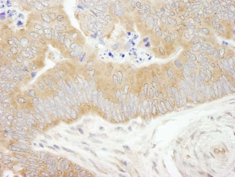 EIF2S1 Antibody (aa275-C-term)
