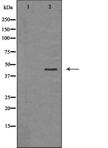 SERPINB3 Antibody