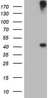 AGPAT5 Antibody (clone OTI2C4)