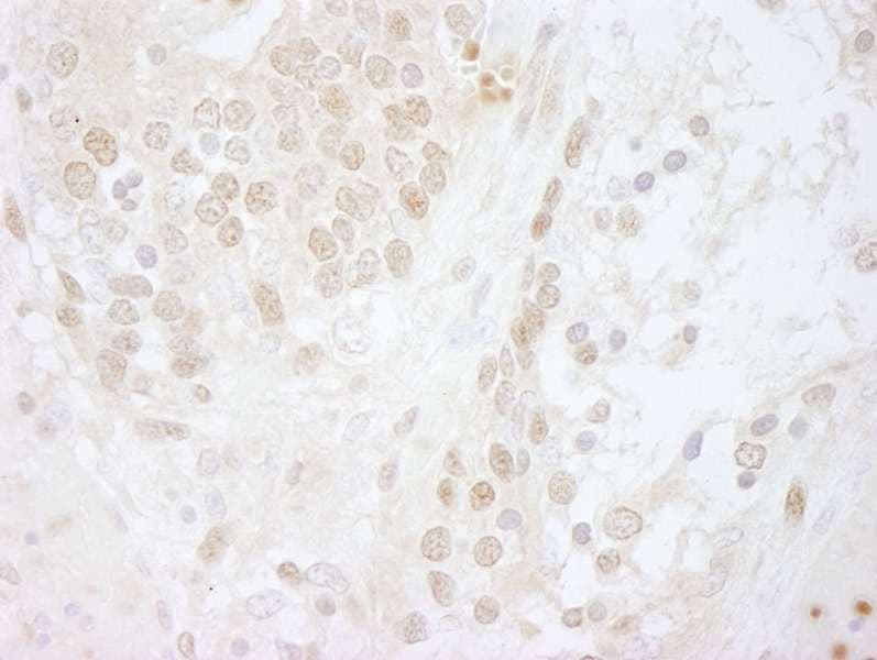 Polyclonal Rabbit anti-Human COPS5 / JAB1 Antibody (aa175-225, IHC)