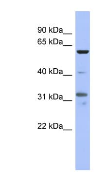 Polyclonal Rabbit anti-Human PAX8 Antibody (aa215-264, IHC, WB)