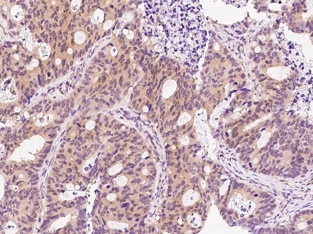 GCG / Glucagon Antibody (Preservative Free)