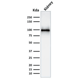 MME / CD10 Antibody (clone MME/1892)