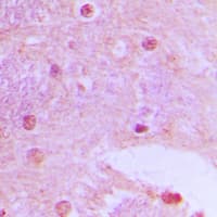 TAF6L Antibody (N-Terminus)