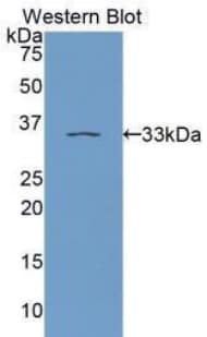 PRKCE / PKC-Epsilon Antibody (aa403-672, APC)