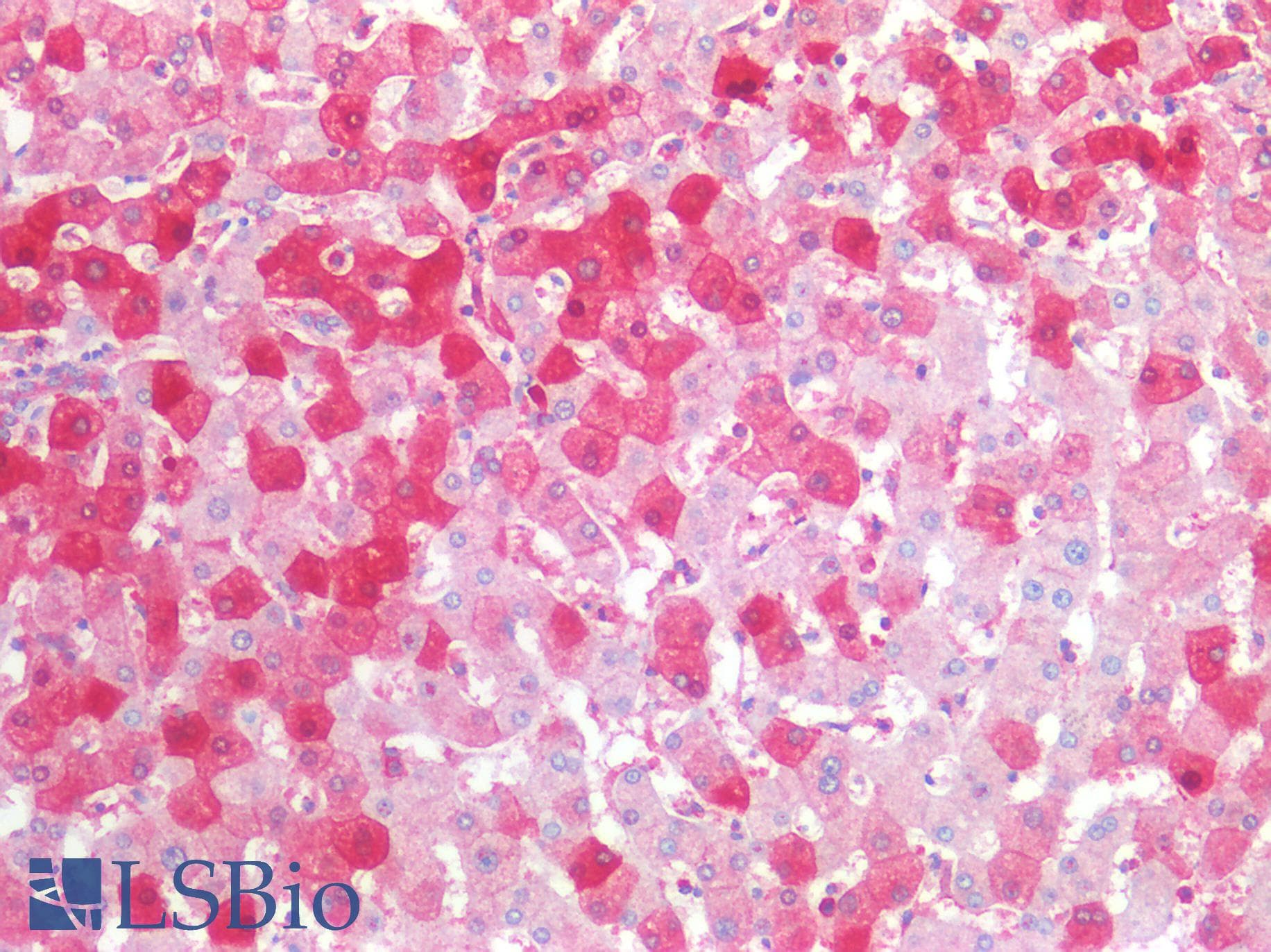 PathPlus™ MVP / VAULT1 Antibody (aa158-380)