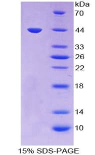 Rabbit MGP / Matrix Gla-Protein (Recombinant His-GST)
