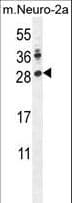IHC-plus™ Polyclonal Rabbit anti-Human LIN28A / LIN28 Antibody (aa108-138, IHC, IF, WB)