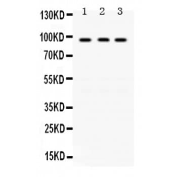 KAT2A / GCN5 Antibody (aa75-106)