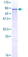 Human ING3 Protein (Recombinant GST)