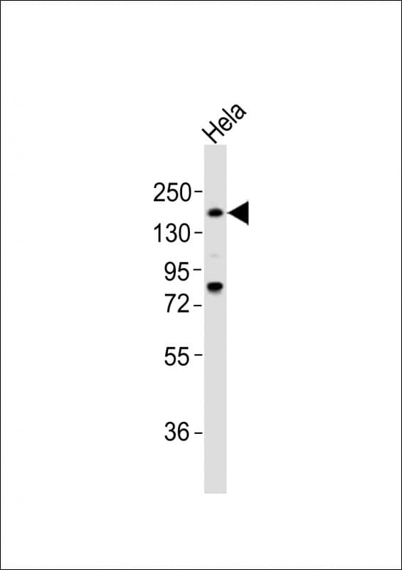 IHC-plus™ LAMA4 / Laminin Alpha 4 Antibody (aa1474-1508)
