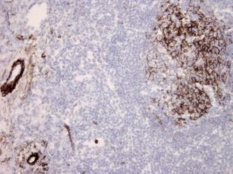 Complement C9 Antibody (clone aE11)