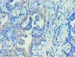 PRKAB2 / AMPK Beta 2 Antibody (aa1-272)
