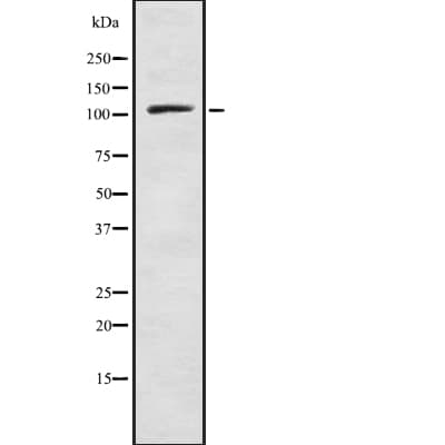 SART3 Antibody