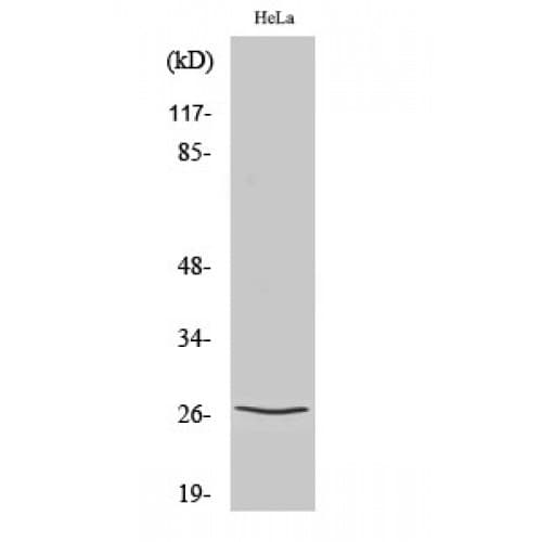 Polyclonal Rabbit anti-Human CDKN1B / p27 Kip1 Antibody (140-220 aa, WB)
