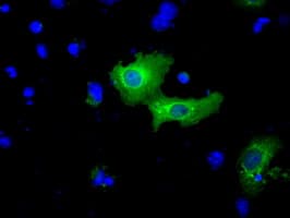BIRC5 / Survivin Antibody (clone OTI2D9)