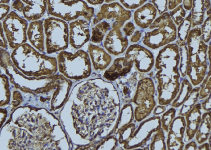 HAUS2 Antibody