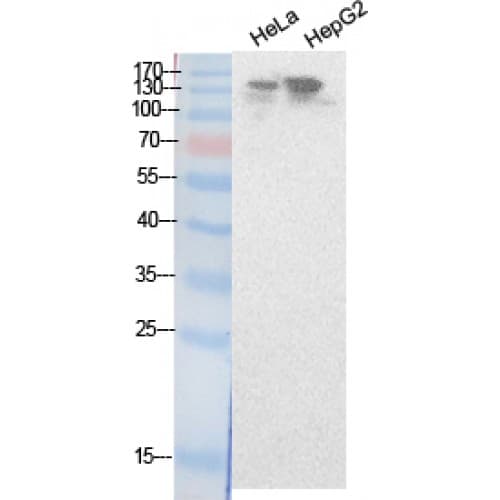 NCOA3 / SRC-3 / AIB1 Antibody (Internal)