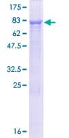 Human CCDC76 Protein (Recombinant GST)