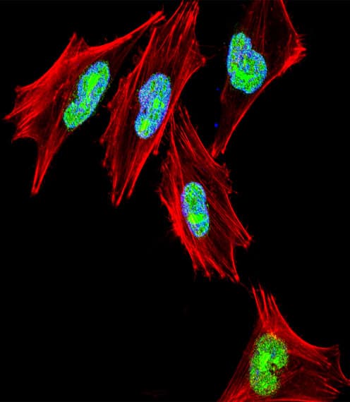 IHC-plus™ TBX1 Antibody (aa327-356)