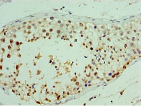 Polyclonal Rabbit anti-Human RDM1 Antibody (aa125-284, IHC)