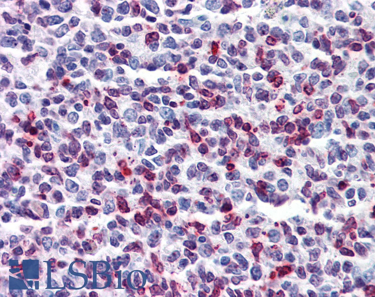 DENND1B Antibody (aa108-157)