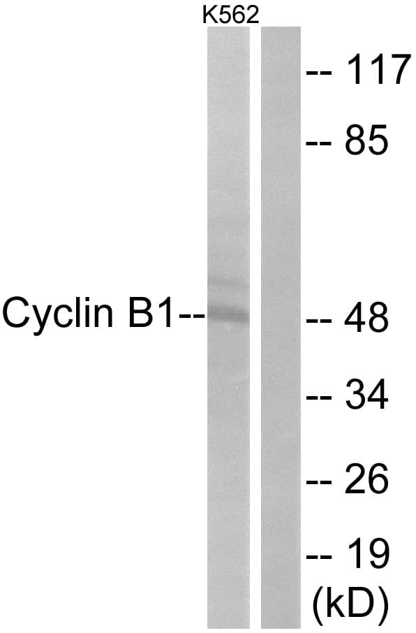 CCNB1 / Cyclin B1 Antibody (aa91-140)