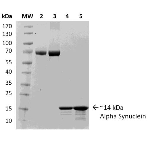 Human SNCA / Alpha-Synuclein Protein (Recombinant)