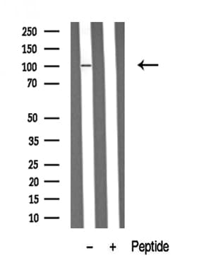 RBBP8 / CTIP Antibody