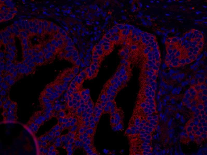 CORO1B Antibody (aa450-489)