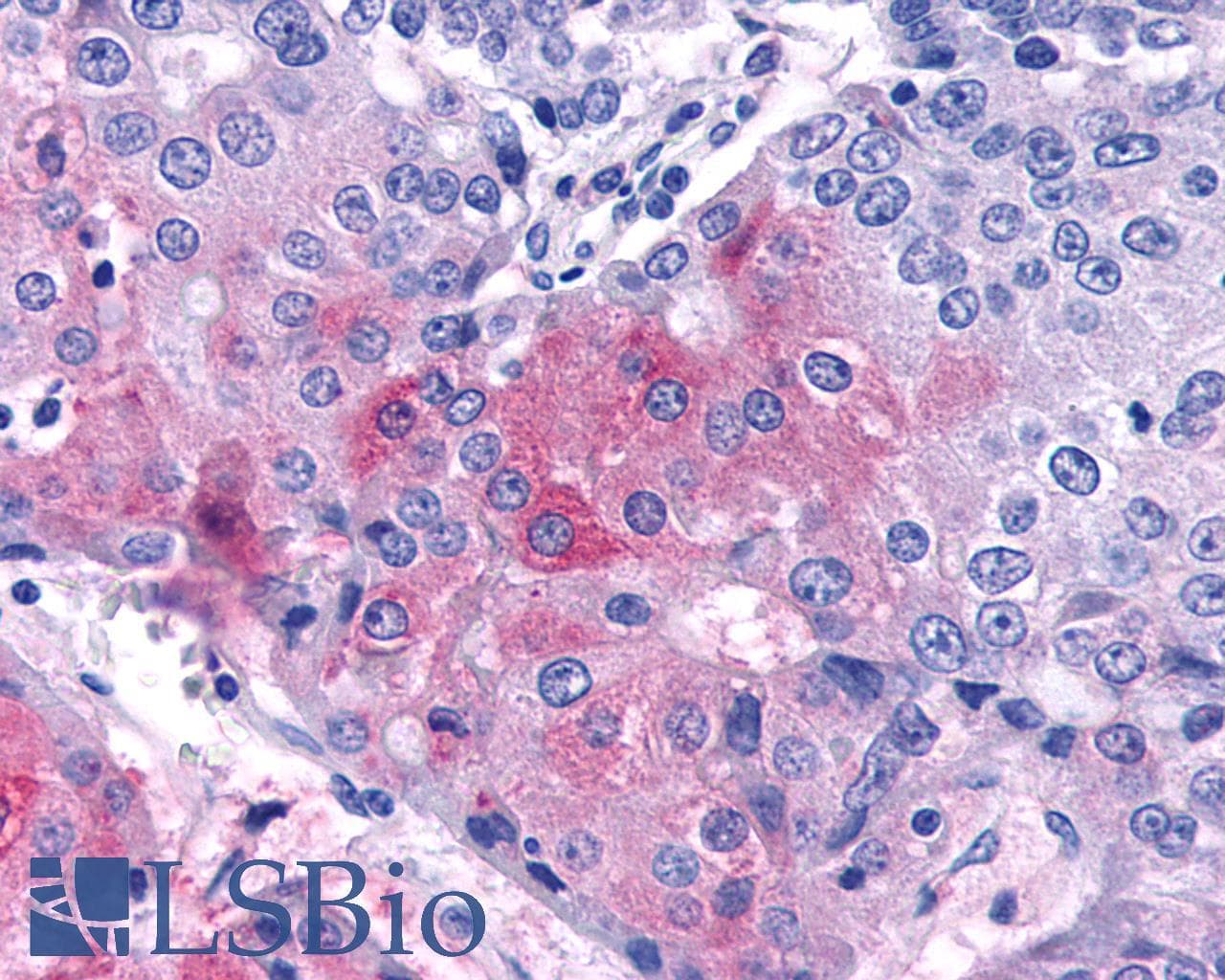PathPlus™ VPAC2 / VIPR2 Antibody (C-Terminus)